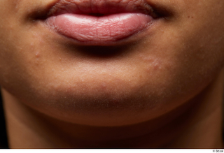 HD Face Skin Candela Ros chin face lips mouth skin…
